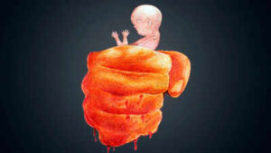 ‘Killers’ of the womb: A son obsession | Delhi News