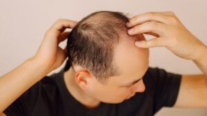 Scientists develop plant-based serum that regrows hair within weeks |