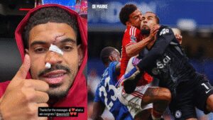 Horror on the pitch: Nottingham Forest star posts gruesome head injury after Chelsea win | Football News