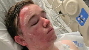 McDonald’s worker left in ICU after colleague throws scalding oil on him, mother launches fundraiser: ‘The pain he’s experiencing…’