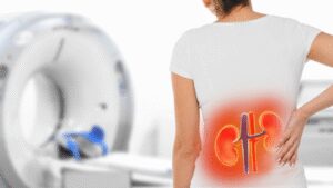 Kidney Health: She replaced regular meals with concentrated vegetable juices to lose weight; Three months later, she developed acute kidney injury