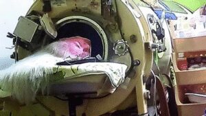 Martha Lillard: Martha Lillard, last US polio patient using iron lung, dies